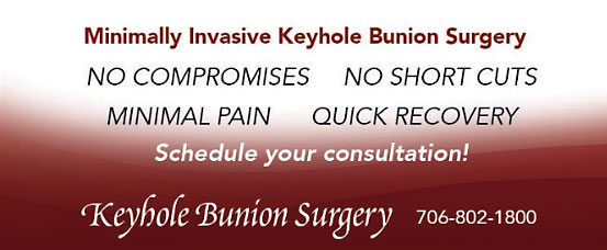 keyhole bunion banner