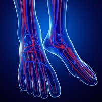 What Is Morton’s Neuroma?