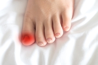 Why That Sore Toe Could Be an Ingrown Toenail