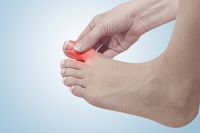Symptoms and Risk Factors of Gout