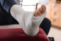 Acute Metatarsal Fractures and Proper Aftercare
